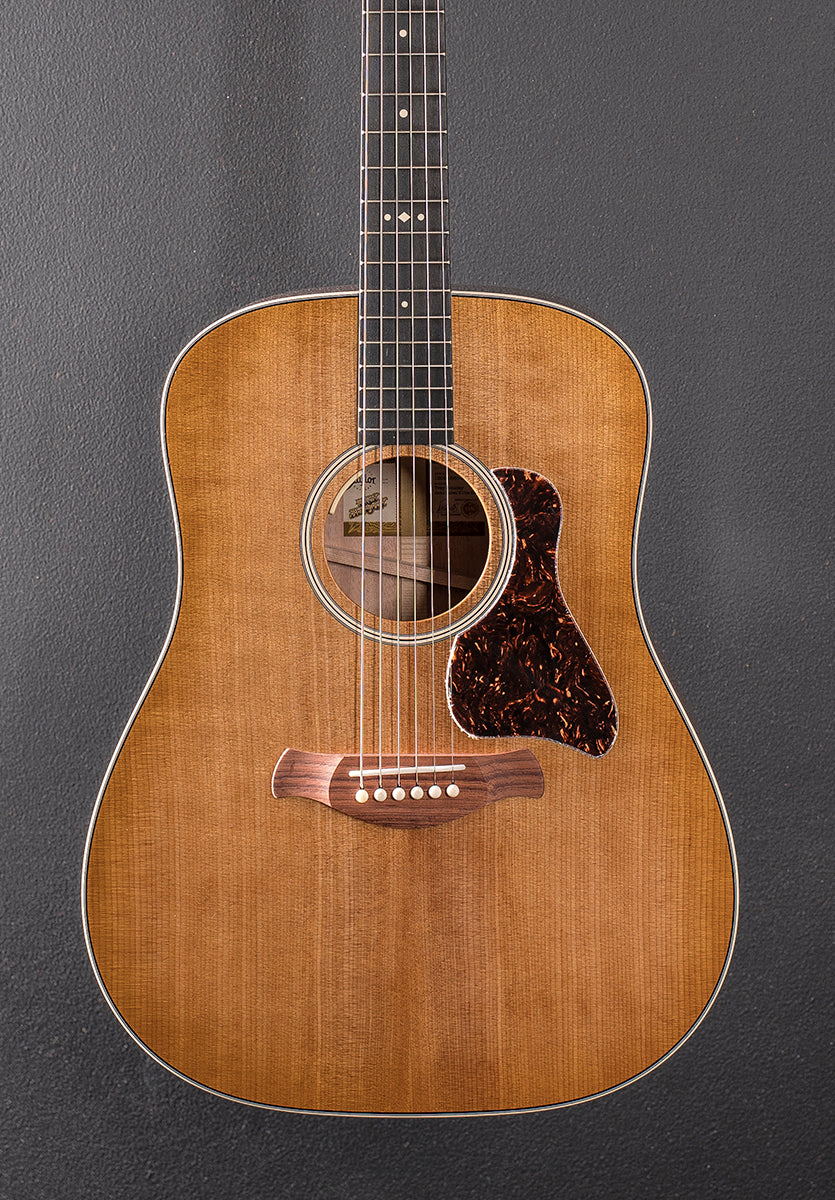 Trey Hensley Gold Label 510E - Image 2